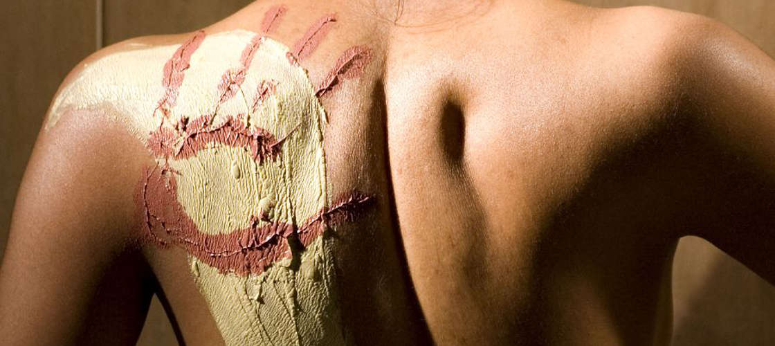 Thumbnail for gallery